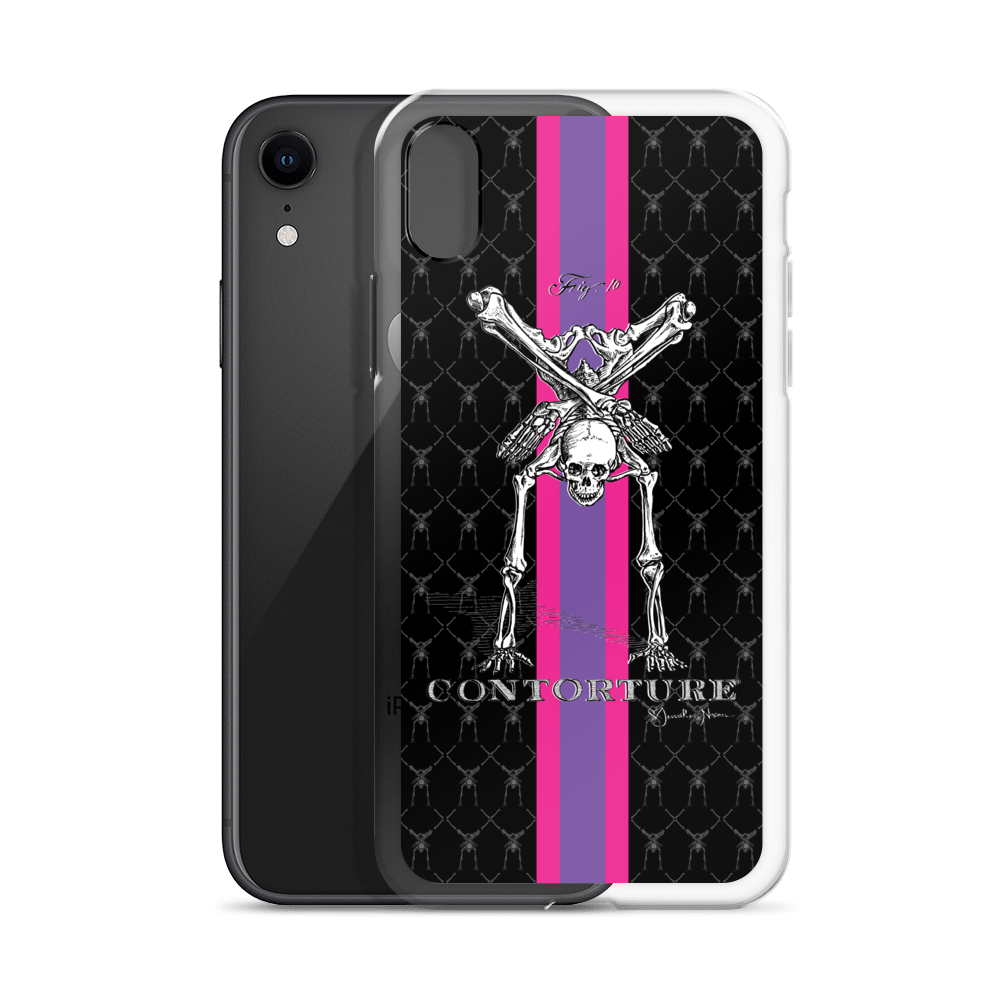 Contorture iPhone Case: SuperStripe Contortion Skeleton